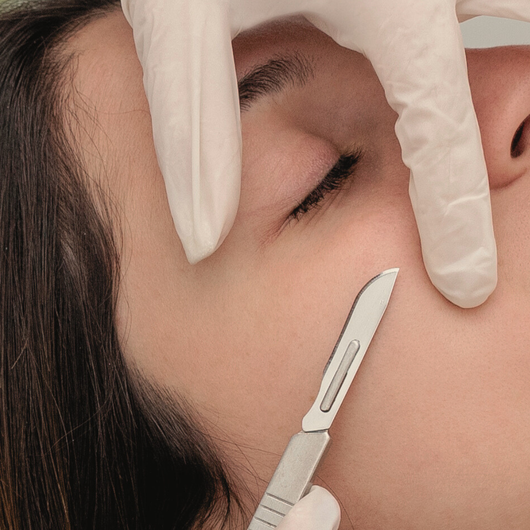 Peach Fuzz Off Image