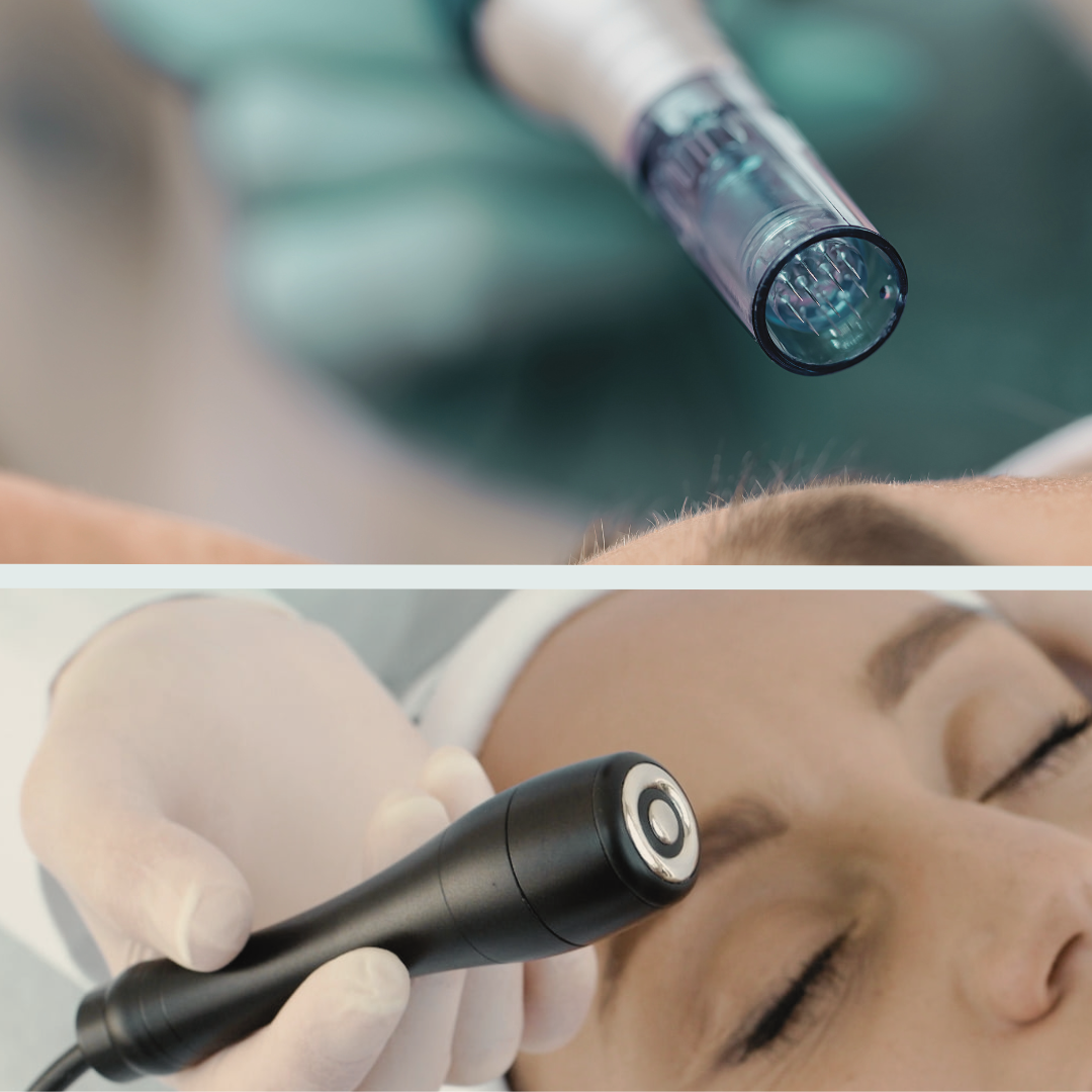 RF & Micro Needling Image