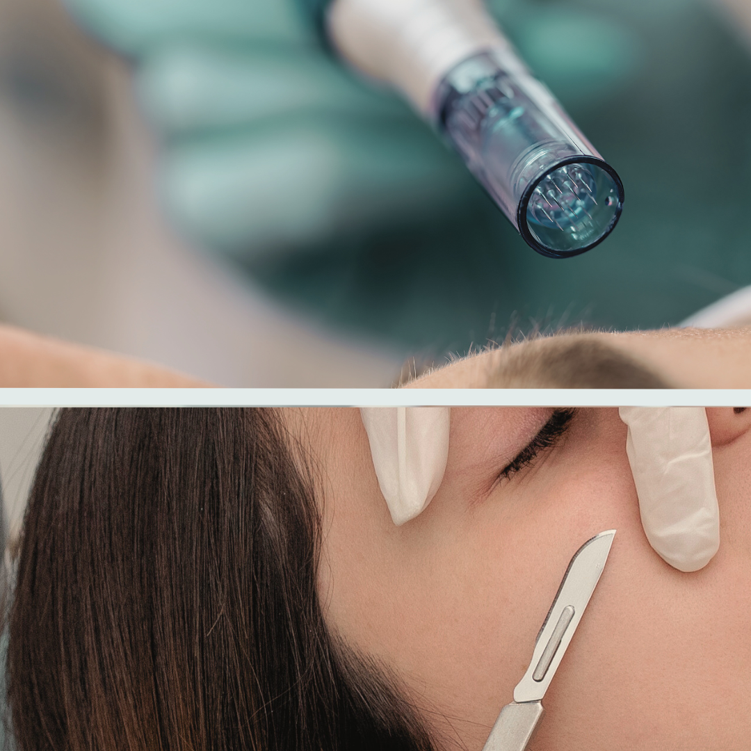 The Red Carpet Image